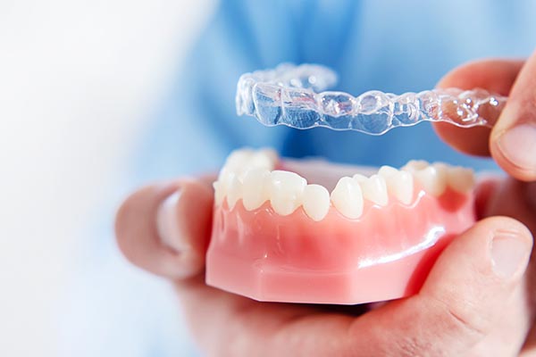 FAQs: Clear Aligners For Adults