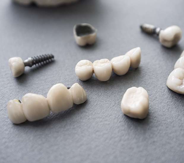 Farmington The Difference Between Dental Implants and Mini Dental Implants