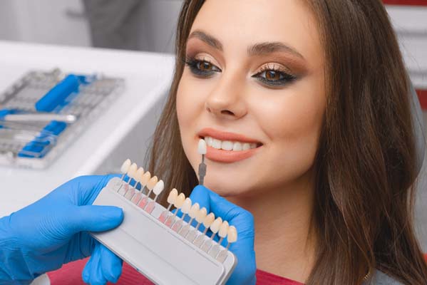 FAQs About Dental Veneers